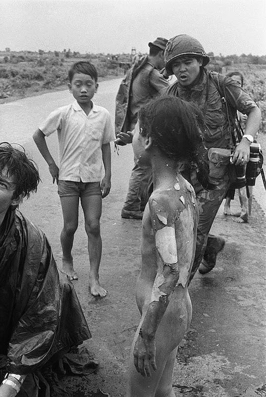 Die gleiche Szene, fotografiert vermutlich von David Burnett, zeigt die fürchterlichen Brandwunden. Christopher Wain…